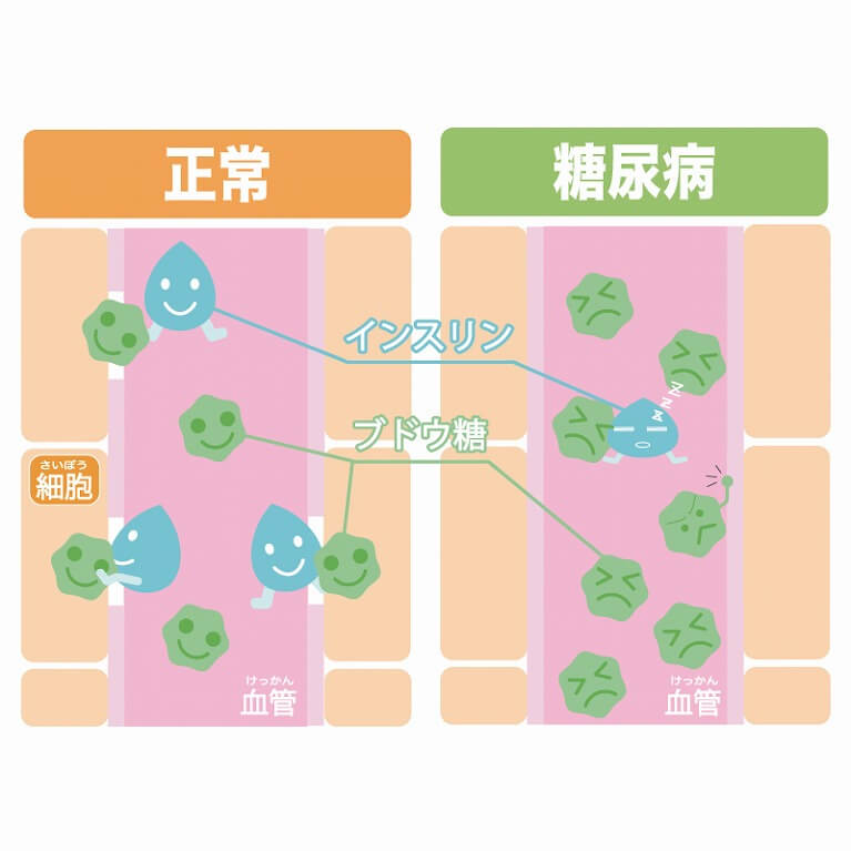 大阪で糖尿病にお困りの方は当院へご相談ください