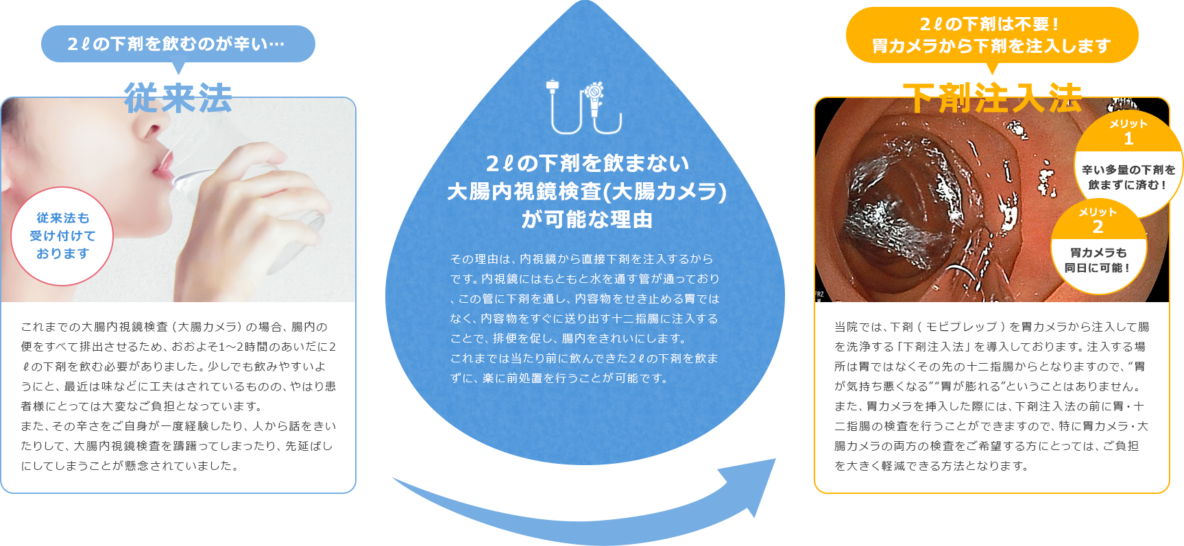 2lの下剤を飲まない大腸内視鏡検査(大腸カメラ)なら大阪の玉城クリニック